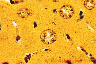 <i>H. hepaticus</i> 実験感染SCIDマウスの肝組織 (Warthin-Starry染色像) : 肝毛細胆管腔内に好銀性の螺旋状桿菌