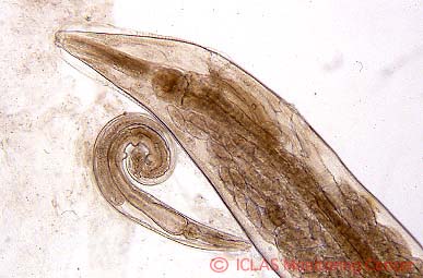  <i>S. obvelata</i>  (ネズミ盲腸蟯虫) 成虫: 光学顕微鏡像
