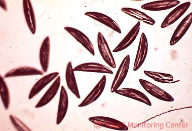 <i>S. obvelata</i> (ネズミ盲腸蟯虫) 虫卵: 光学顕微鏡像