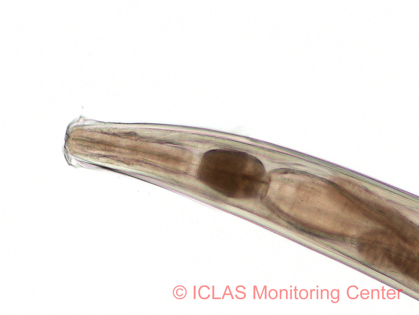 <i>A. tetraptera</i> 雌成虫頭部の光学顕微鏡像拡大