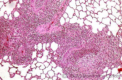 <i>M. pulmonis</i> 自然感染ラットの肺組織 (H&E染色像) : 気管支性肺炎