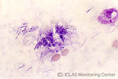 <i>C. piliforme</i> 実験感染ラットの肝臓割面スタンプ標本 (May-Giemsa染色)