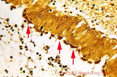右: CAR bacillus自然感染ラットの肺組織 (Warthin-Starry染色) : 気管支上皮細胞の線毛に好銀性細菌の付着 (矢印)