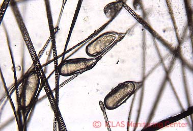 <i>M. musculi</i>  (ハツカネズミケモチダニ) 虫卵がマウス被毛に付着