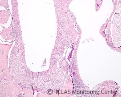 <i>B. hinzii</i> 自然感染C57BL6系マウスの鼻腔組織 (H&E染色像) : 副鼻腔炎