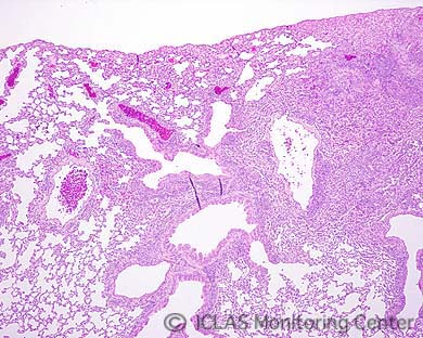 右: <i>B. hinzii</i> 自然感染C57BL6系マウスの肺組織 (H&E染色像) : 気管支性肺炎