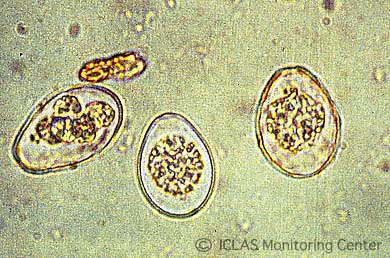 <i>E. intestinalis</i>  (腸管型) のオーシスト